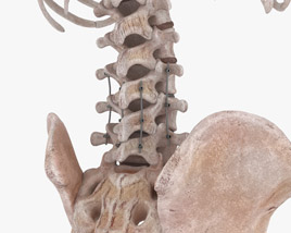 Spinal Fixation System 3D model